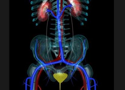 Types of Urinary Incontinence